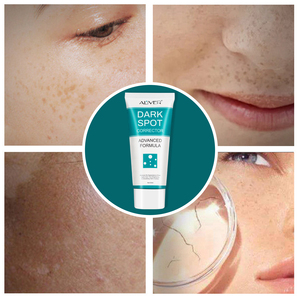 <span class=keywords><strong>ALIVER</strong></span>-soin pour le visage, crème hydratante, élimine les cernes, perle d'aloe vera, élimine les taches de rousseur melasma, blanchissante, 60ml - Product Image 4