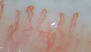 सटीक स्वास्थ्य निगरानी के लिए उन्नत रंग माइक्रोसर्सर्कुलेशन डिटेक्टर - Product Image 5