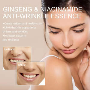 Esencia Facial Hidratante Antiarrugas con Ginseng y Niacinamida, Complejo Radiante, Reduce las Arrugas, Aumenta la Elasticidad, 100 ml - Product Image 5