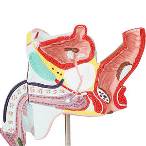 Modelo Patológico del Sistema Reproductor Masculino - Herramienta de Enseñanza Médica de Andrología y Comunicación Médico-Paciente - Product Image 5