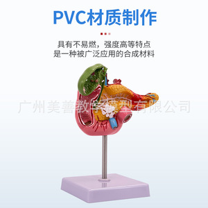 Modèles pathologiques simulés du pancréas, du duodénum et de la vésicule biliaire ; enseignement des spécimens du système digestif, y compris - Product Image 1