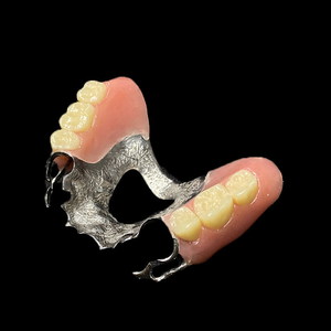 Prothèse avancée d'alliage de chrome de cobalt avec la technologie de moulage de précision - Product Image 5