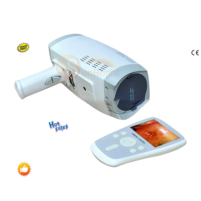 Medical Digital Camera System for Gynecological Use Factory Direct Sales Video Colposcope