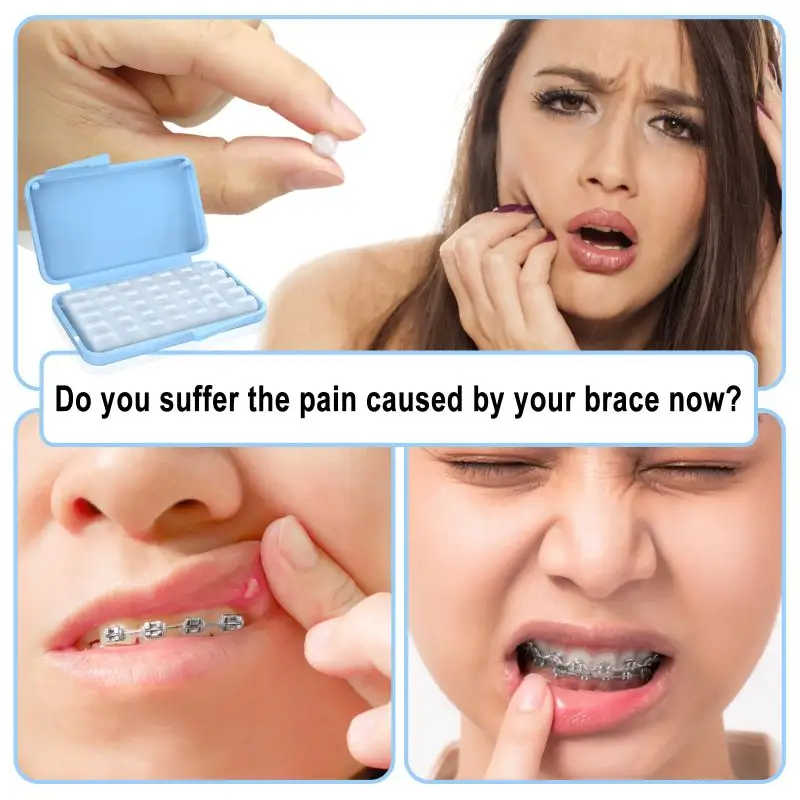 Sản phẩm mới sức khỏe răng miệng tất cả các vật liệu tự nhiên nha khoa Brace sáp thơm Ortho sáp cho chỉnh nha điều trị