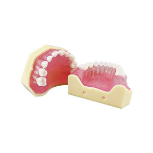 Modèle de pratique d'extraction dentaire pour la formation en dentisterie pédiatrique, modèle anatomique en résine amovible, modèle standard - Product Image 4
