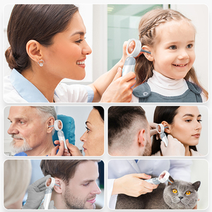 Caméra numérique portable intelligente PAKISS <span class=keywords><strong>pour</strong></span> le nez, la gorge et l'oreille, avec écran LED, photos et vidéos, 2MP, 1080P HD, otoscope, utilisation à domicile - Product Image 2
