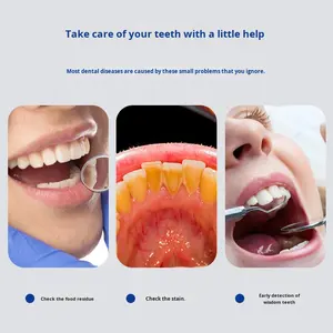 Specchio Dentale Manuale Fukeda R1 con Luce, Endoscopio Antiappannamento per Esame Domestico, Certificato CE, Garanzia 1 Anno - Product Image 2