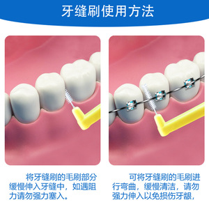 Cepillo Interdental en Forma de L con Cerdas de Acero Inoxidable, Paquete de 10 Unidades, Cerdas Suaves para Cuidado Bucal - Product Image 5