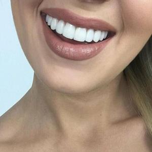 Vente chaude sourire parfait accolades encliquetables facettes dentaires pour l'enseignement et accolades temporaires couvrent les dents imparfaites - Product Image 6