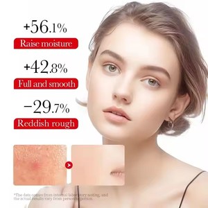 Crème Apaisante au Céramide OEM ODM : Améliore l'État Cutané Inconfortable, Équilibre le Teint Sensible, Soin Quotidien Doux pour le Visage - Product Image 4