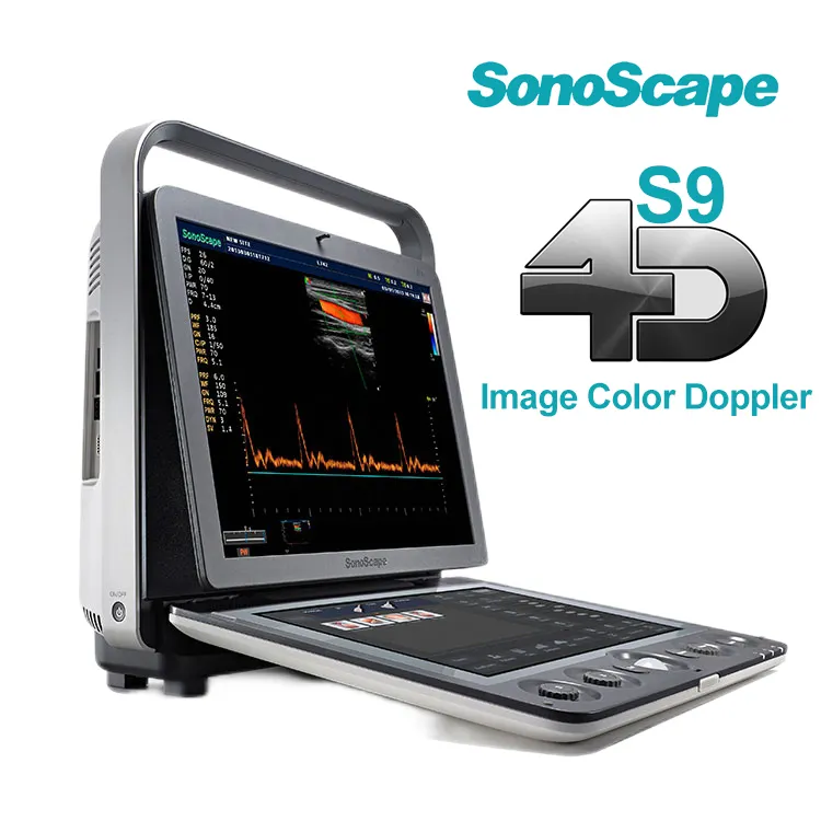 휴대용 3D 4D 컬러 도플러 USG & Sonoscape S9