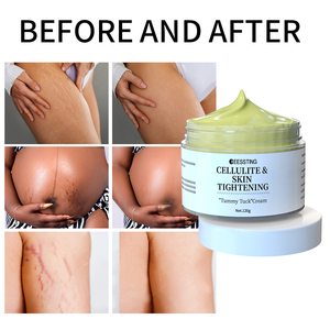 OEM ODM Orgánico Vegano Eliminación de cicatrices profundas Reparación Apriete Anti espinillas Estrías Crema de eliminación de cicatrices Crema de abdominoplastia - Product Image 2