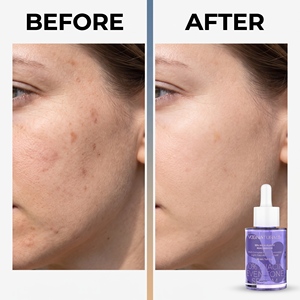 Suero Facial con 10% de Niacinamida B3, Extracto de Raíz de Cichorium Intybus, Corrector de Manchas Oscuras, Corrector de Decoloración, Manchas Solares/de <span class=keywords><strong>la</strong></span> Edad - Product Image 5