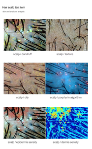 Analizador de Piel y Cuero Cabelludo Todo en Uno con IA, Detector Inteligente de Microecología del Cuero Cabelludo y Folículos Pilosos - Product Image 3
