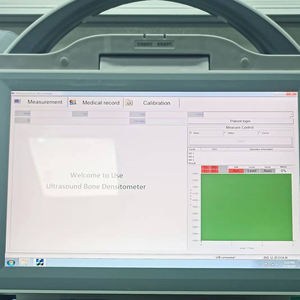 Densitometro oseo por ultrasonido portátil, limpiador de densidad, osea, para clinica - Product Image 2