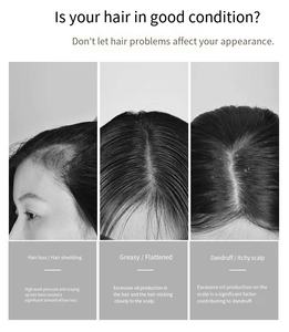 Shampooing Anti-Chute et Anti-Pelliculaire au DNA et à l'Huile, Testé par les Utilisateurs, Réduit la Chute des Cheveux en 1 à 3 Semaines, Soin du Cuir Chevelu pour Hommes et Femmes - Product Image 3