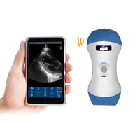 Sistema de ultrasonido de matriz en fase inalámbrico Suresult para uso médico de múltiples manijas Doppler de color