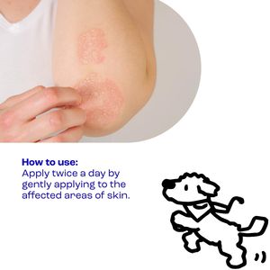 <span class=keywords><strong>Crema</strong></span> <span class=keywords><strong>Facial</strong></span> Vegana y Libre de Sulfatos <span class=keywords><strong>para</strong></span> Alivio de la Piel, <span class=keywords><strong>Eczema</strong></span>, Prurito y Hongos, Efecto Potente, Libre de Crueldad Animal, Marca Privada OEM/ODM - Product Image 3