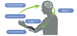 XFT alat terapi rehabilitasi tangan, stimulasi elektrik <span class=keywords><strong>Stroke</strong></span> NMES, latihan rehabilitasi fungsi tangan, Stimulator saraf - Product Image 5