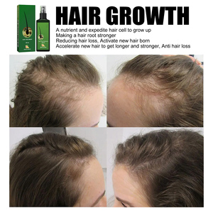 Private Label 100% Natural Gengibre Feg Crescimento Do Cabelo Spray Tratamento Original Crescimento Do Cabelo Spray Melhorar O Óleo De Crescimento Do Cabelo Rápido - Product Image 3
