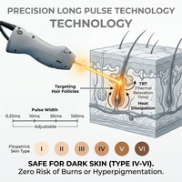 Laser professionnel d'épilation 755/1064nm à double impulsion, grande spotte de 20 mm, pour dermatologie, élimination vasculaire, rajeunissement rapide en milieu hospitalier