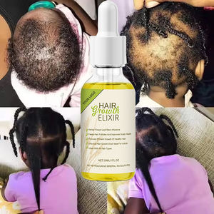 Grosir Label pribadi minyak rambut Rosemary organik terbaik perawatan kulit kepala alami untuk penumbuh ulang rambut cepat dan perbaikan untuk uniseks - Product Image 1