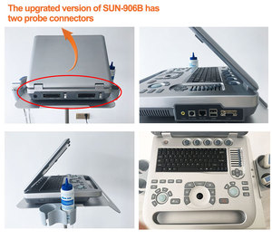 15 inch <strong>Colour</strong> <strong>Doppler</strong> Cardiac CW TDI Ultrasound Scanner Portable <strong>Echocardiography</strong> Machine - Product Image 6