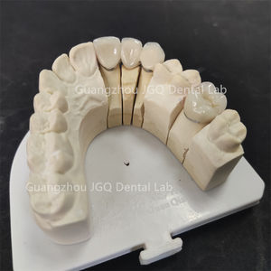 Corone dentali porcellane-fuse-to-Metal (<span class=keywords><strong>PFM</strong></span>) di alta qualità con aspetto naturale simile a un dente - Product Image 4