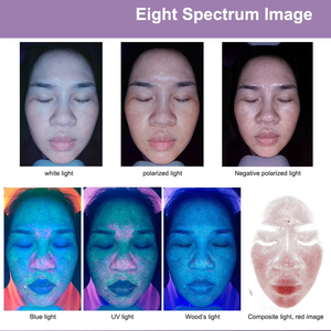 Nouveau système de diagnostic UV professionnel 3D AI pour la peau et le visage avec écran de 21,5 pouces, détecteur et scanner miroir - Product Image 4
