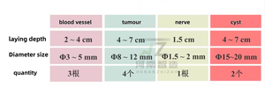 Nuovo Modello di Simulazione per Puntura ad Ultrasuoni Zhizao, Modello Completo per Formazione su Tumori Vascolari e Cisti Nervose - Product Image 5