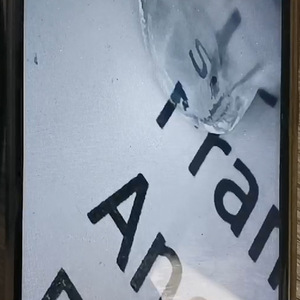 ZCF Android Visual Ear Pick 30W Pixels 5.5mm Lens Black Blue High Definition Endoscope For Ear Wax Removal - Product Image 4