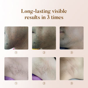 מכשיר שפופרת להסרת שיער בלייזר LEAFLIFE 510K 25J <span class=keywords><strong>100</strong></span> מיליון יריות תוצאות ללא כאבים וקבועות לטיפול בכל הגוף - Product Image 3