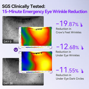 LANBENA علامة خاصة ريتينول مضاد للتجاعيد مضاد للشيخوخة ترطيب تحت دعم Oem - Product Image 4