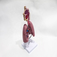 Modelo Comparativo de Lesiones Pulmonares y Bronquiales por Asma para Entrenamiento en Patología Médica, Ayuda Didáctica, CE/ISO/ROHS/CNAS