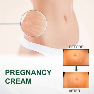 Crème réparatrice des vergetures à base de plantes EELHOE, vente en gros transfrontalière, perte de poids pour la grossesse, récupération après l'accouchement, soin de la peau - Product Image 3