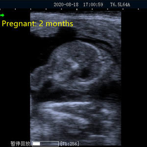 Ecógrafo para Animales, Escáner de Embarazo para Cerdas, Escáner Ultrasónico para Animales de Granja, Ultrasonido Veterinario Modo <span class=keywords><strong>B</strong></span> - Product Image 6