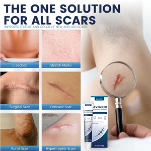Crème réparatrice <span class=keywords><strong>anti</strong></span>-cicatrices à base de plantes pour les vergetures de grossesse, réparation rapide, soin de santé, <span class=keywords><strong>pommade</strong></span> - Product Image 2