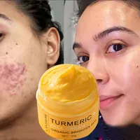 LAN THOME kosmetische Bio-Whitening-Creme Gesicht Körper Auge Kurkuma Anti-Falten Anti-Pickel Akne Creme für Frau Hautpflege