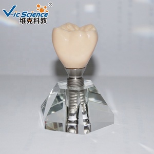 Modèle d'implant dentaire stéréoscopique Dents et modèle dentaire Modèle d'implant dentaire pour les applications en sciences médicales - Product Image 1