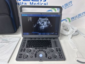Escáner de Ultrasonido Veterinario <span class=keywords><strong>Sonoscape</strong></span> E1V <span class=keywords><strong>E1</strong></span> y Ultrasonido en Blanco y Negro para Uso Veterinario y Venta para Clínicas y Hospitales de Mascotas - Product Image 4