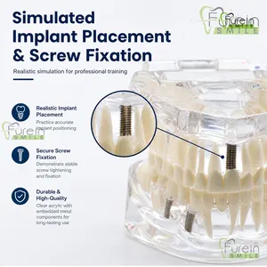 Modelo de Restauración Dental con Dientes Removibles, Implante, Corona y Puente, para Demostración y Estudio, para Educación y Entrenamiento de Dentistas - Product Image 4