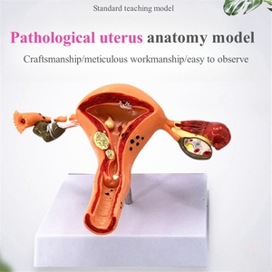 Phòng thí nghiệm công cụ giảng dạy phụ khoa mô hình tử cung bệnh lý con người Mô hình giải phẫu cơ quan sinh sản nữ Sản phẩm khoa học y tế - Product Image 2