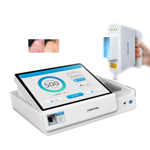 Noyau UVB Lampes Photothérapie Traitement Excimer Laser 308nm Psoriasis <span class=keywords><strong>Vitiligo</strong></span> 308nm LED Lumière Dispositif CN-308E - Product Image 5