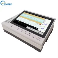 Monitor Fetal para Perros, para Mujeres Embarazadas y Cachorros, Pantalla de 10.2 Pulgadas, Sistema de Cardiotocógrafo Digital, Impresora Térmica de Alta Resolución FM30