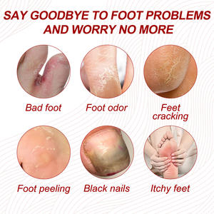 Traitement <span class=keywords><strong>antifongique</strong></span> pour les ongles Ximonth, crème de soin des ongles <span class=keywords><strong>antifongique</strong></span>, 30g - Product Image 2