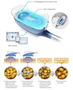 <span class=keywords><strong>Macchina</strong></span> per Criolipolisi e <span class=keywords><strong>Crioterapia</strong></span> per Dimagrimento Corporeo e Riduzione del Grasso Locale - Product Image 3