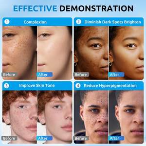 <span class=keywords><strong>Crème</strong></span> pour le <span class=keywords><strong>visage</strong></span> au rétinol QUANXIN Réparation rapide Correcteur de <span class=keywords><strong>taches</strong></span> <span class=keywords><strong>brunes</strong></span> pour hommes et femmes Correcteur de <span class=keywords><strong>taches</strong></span> de vieillesse <span class=keywords><strong>Crème</strong></span> pour la peau à <span class=keywords><strong>taches</strong></span> <span class=keywords><strong>brunes</strong></span> - Product Image 2