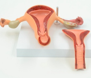 Le modèle de système reproducteur anatomique féminin en PVC pour l'éducation médicale comprend l'utérus, le vagin et l'ovaire avec pathologie - Product Image 2