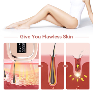 เครื่องกำจัดขน <span class=keywords><strong>IPL</strong></span> แบบพกพาขนาดเล็ก Notime ไม่เจ็บ ใช้ความเย็น สำหรับใบหน้าและมือ ใช้ในบ้าน ปลั๊กแบบ US/CN - Product Image 4