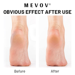 Crème pour les pieds anti-callosités extra forte à étiquette privée, gel anti-callosités, lime à pieds avec outils de pédicure, fournitures, kit de <span class=keywords><strong>spa</strong></span> - Product Image 4